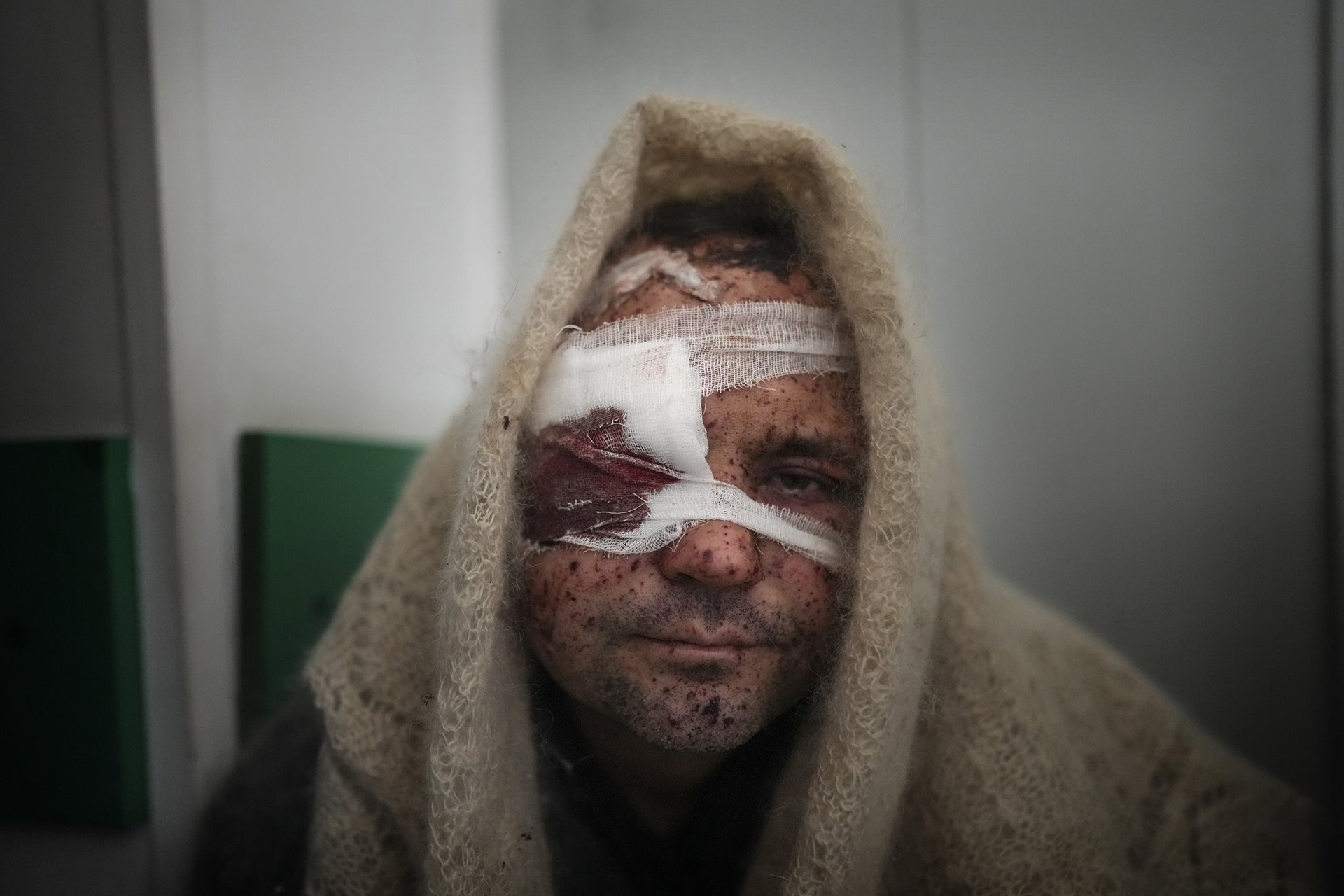 Serhiy Kralya, a civilian injured during shelling by Russian forces, rests after surgery at a hospital in Mariupol, Ukraine.